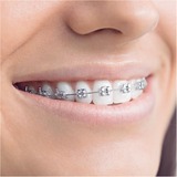 Braun Teen Adolescentes Cepillo dental oscilante Blanco, Negro, Cepillo de dientes eléctrico negro/blanco, Adolescentes, Cepillo dental oscilante, Cuidados diarios, 40000 movimientos por minuto, Blanco, Negro, 8800 movimientos por minuto